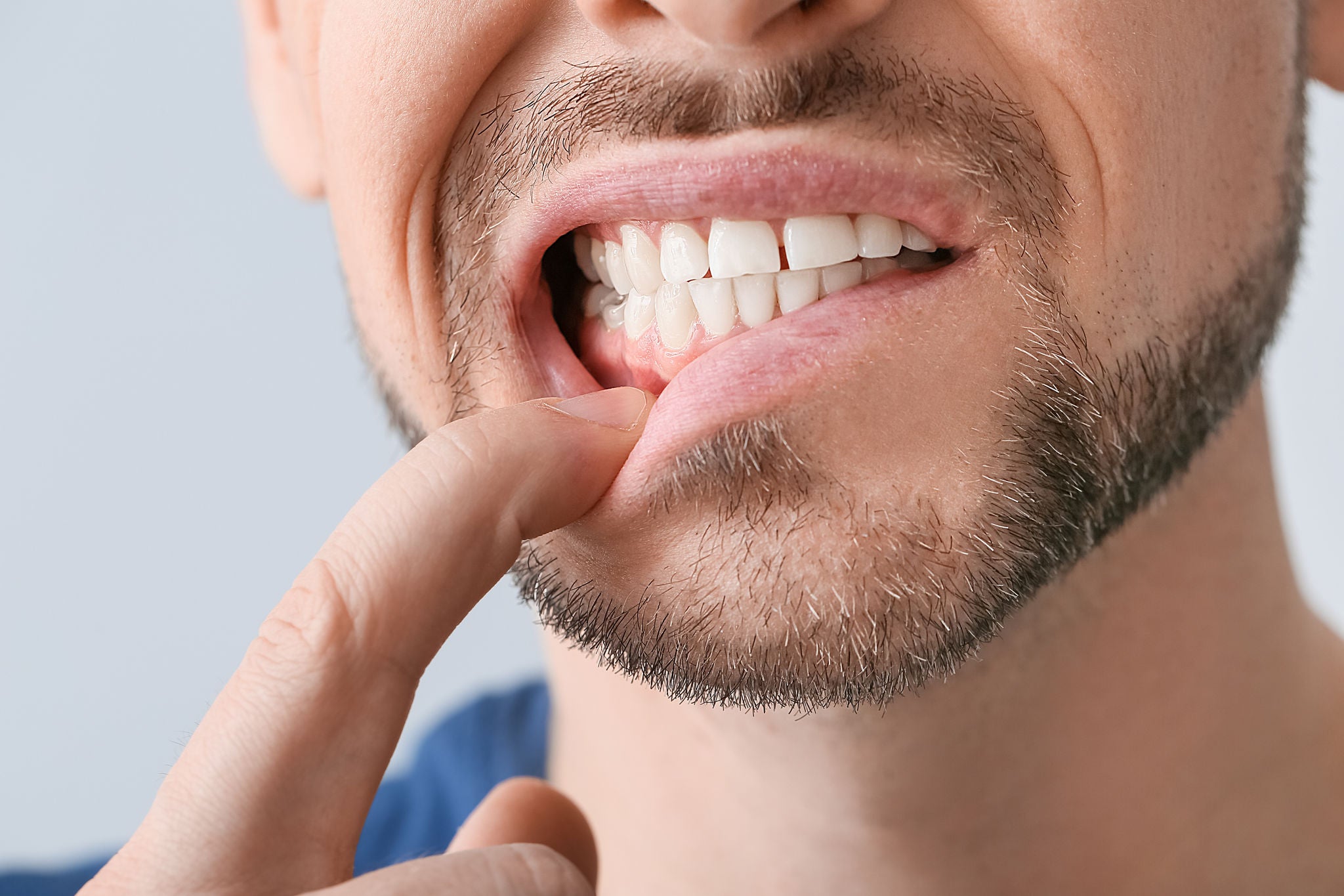 Man suffering from tooth ache, closeup