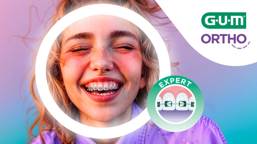 Adolescent souriant avec un cercle autour de la bouche pour mieux voir l’appareil dentaire
