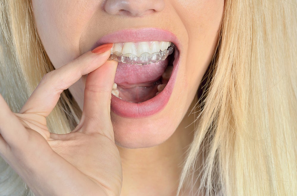 Come pulire il bite ortodontico