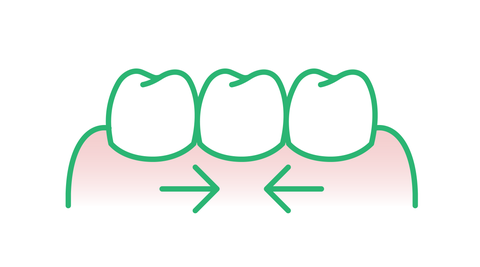 Illu-How-to-Tight-teeth