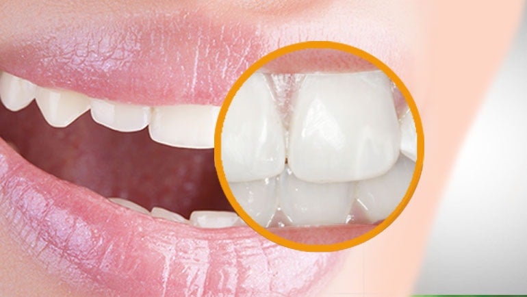 Anatomia del Dente: Come Sono Fatti i Nostri Denti?