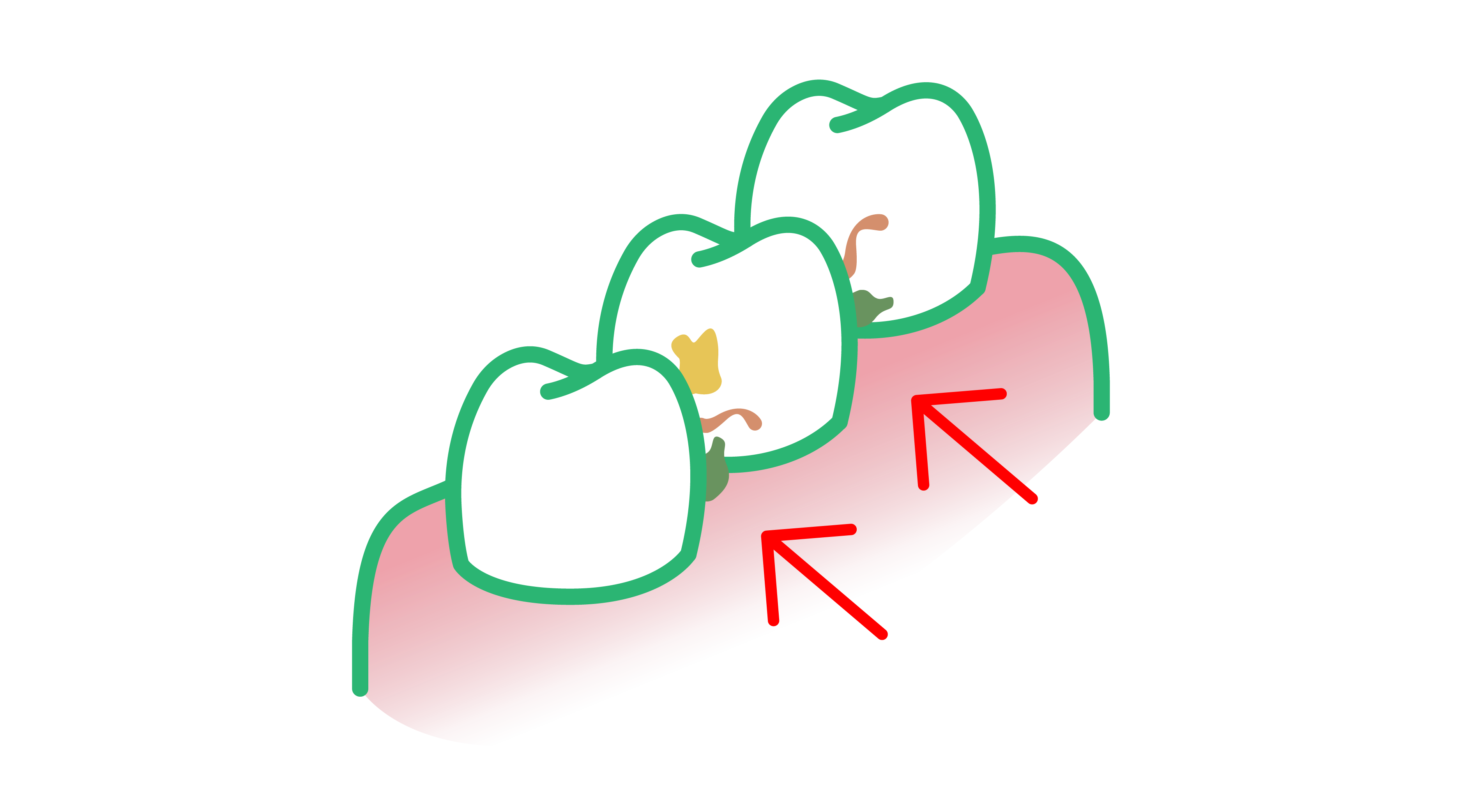 GUM Trav-ler food debris plaque between teeth