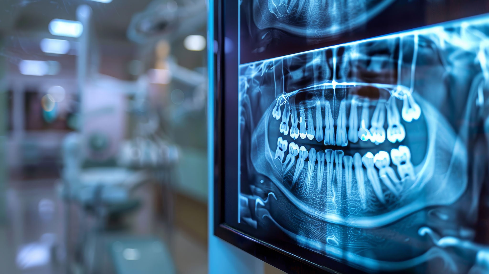 Mascella E Mandibola Quali Sono Le Differenze GUM Mascella E Mandibola Quali Sono Le Differenze GUM