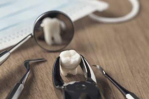 Czy usuwanie zęba z torbielą boli - usunięcie zęba z torbielą