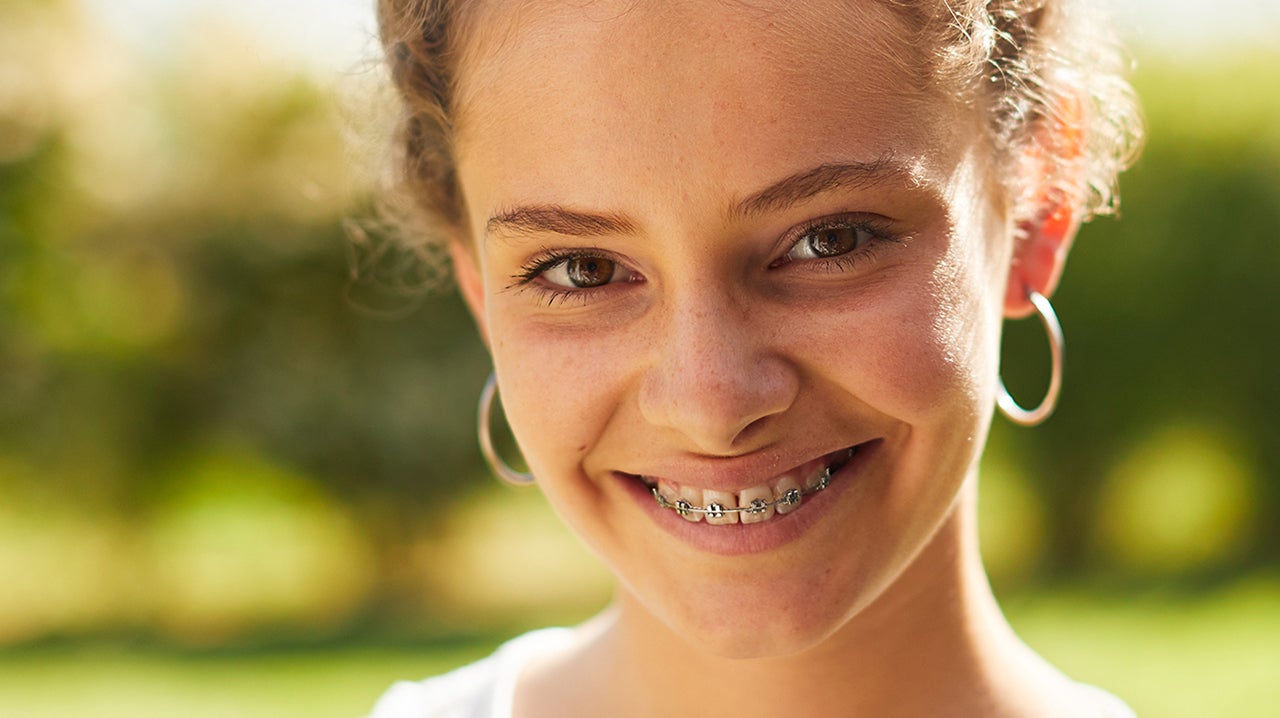 Junges Mädchen mit Zahnspange und verfärbten Zähnen 