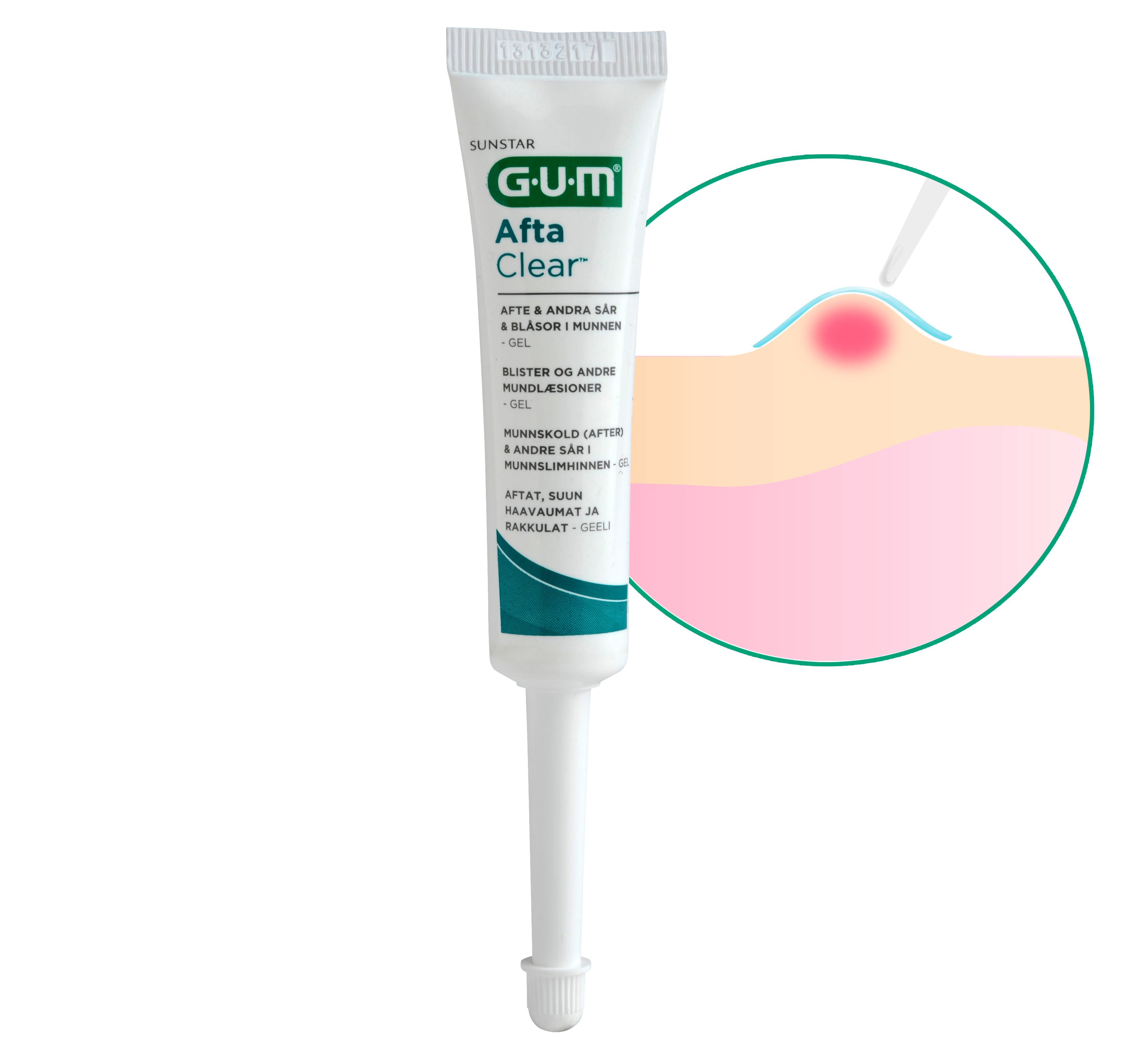 Illu-Afta-Clear-gel-SE