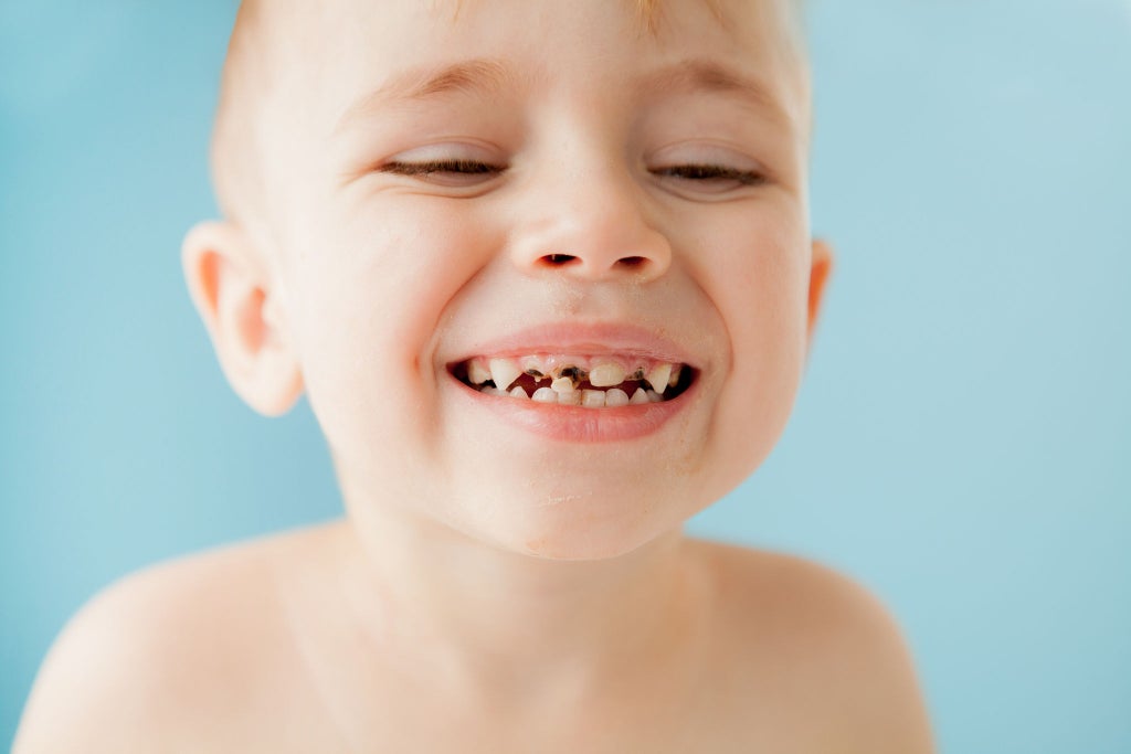 La Dentizione nel Neonato: le Domande più Diffuse