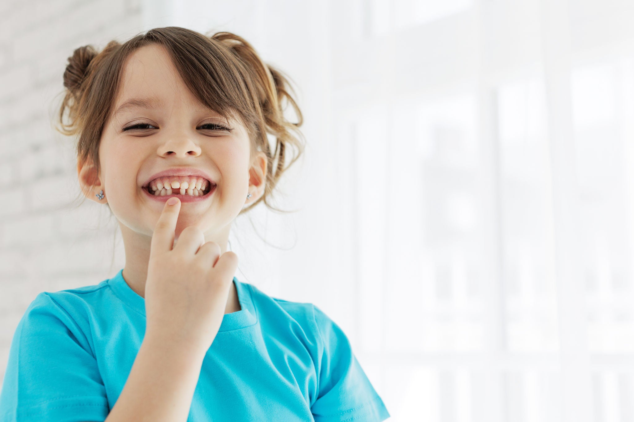 The kid lost a tooth. Baby without a tooth. Portrait of a little girl no tooth. High quality photo