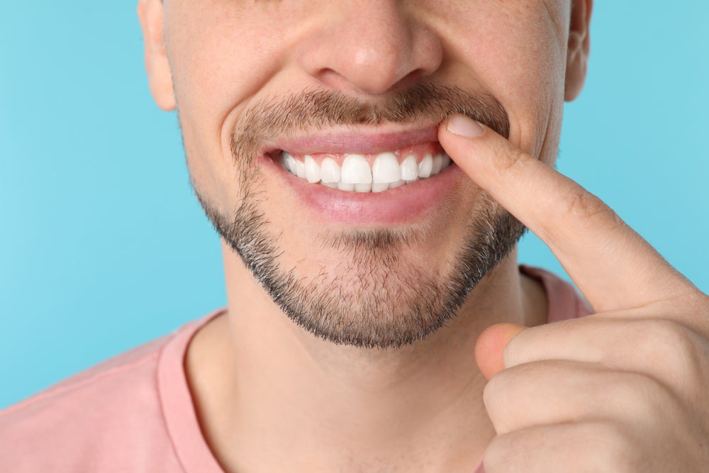 Man showing his teeth