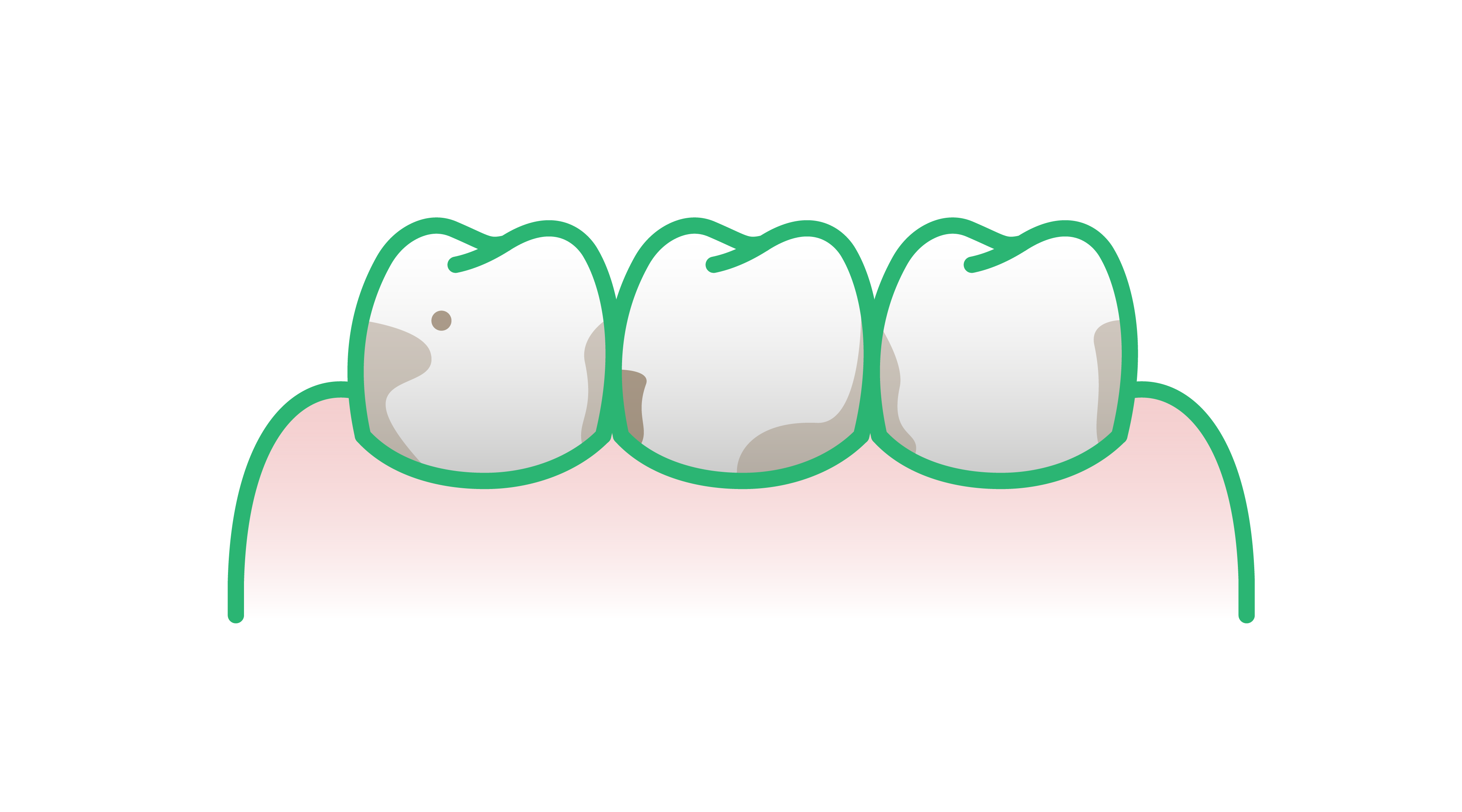 Dents tachées par des aliments et boissons