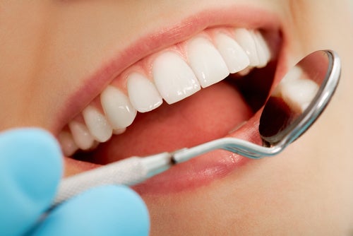 Tout pour éviter le déchaussement des dents