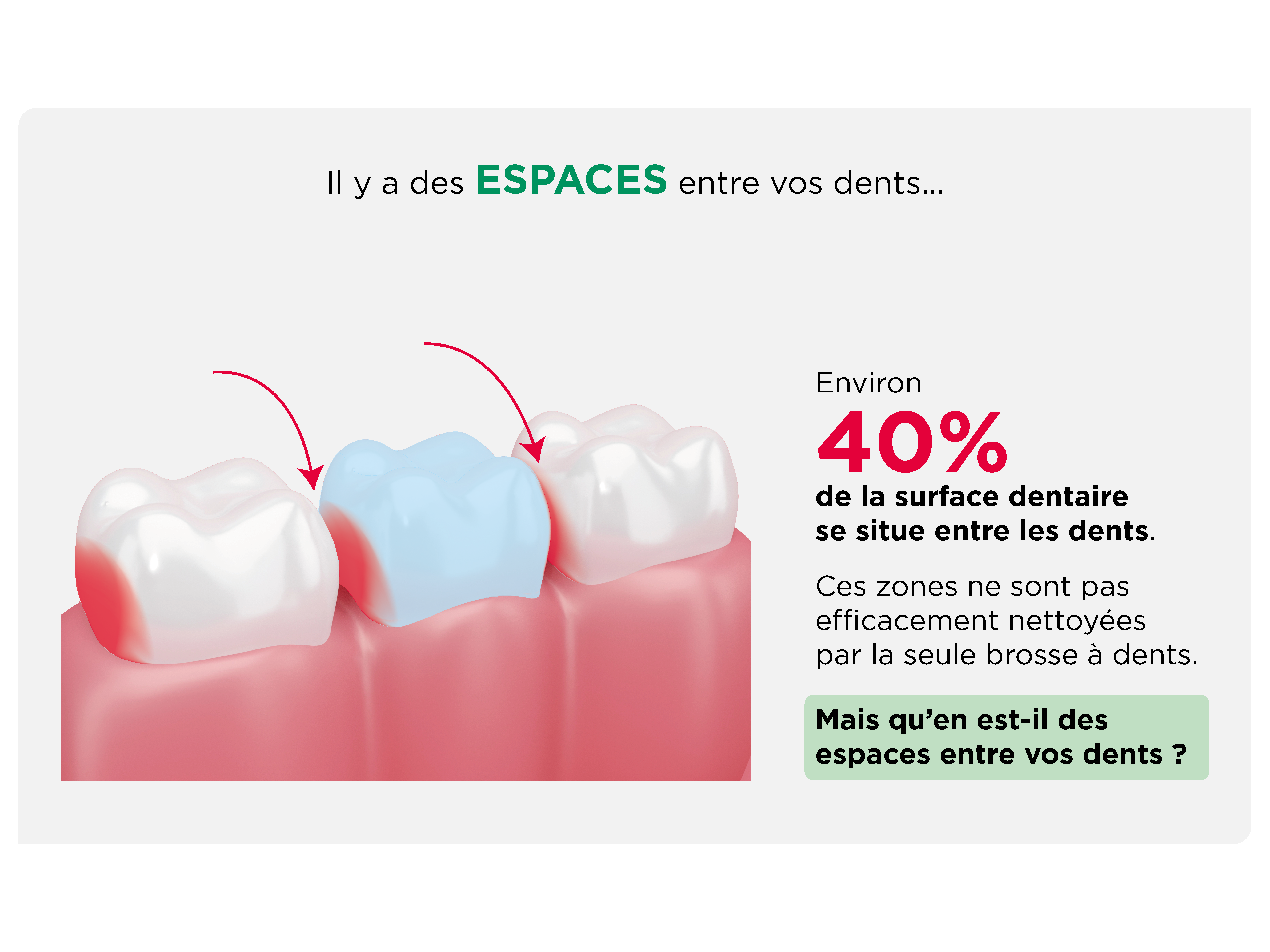 Illustration : environ 40% de la surface dentaire se situe entre les dents, hors d'atteinte de la brosse à dents