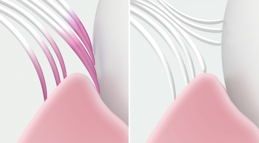 Bristle Comparison: GUM PRO Sensitive vs. Regular Manual Toothbrush