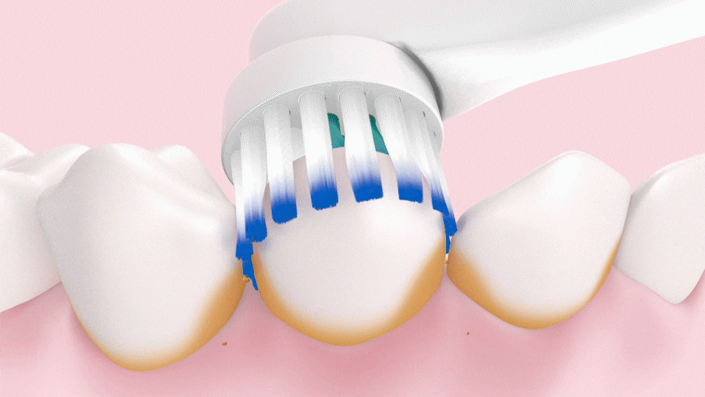 Brosse à dents électrique qui élimine la plaque dentaire