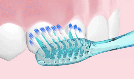 Beim Zähneputzen mehrmals kleine rüttelnde Vor- und Rückwärtsbewegungen ausführen