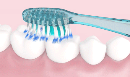 Cepillo de dientes GUM Technique PRO limpiando la superficie masticatoria