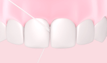 Fil dentaire entre les dents