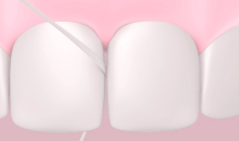 Fil dentaire entre les dents