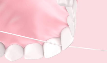 Zahnseide sanft in die Zahnzwischenräume gleiten lassen 