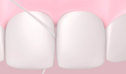 tandtråd mellem fortænderne i nærbillede