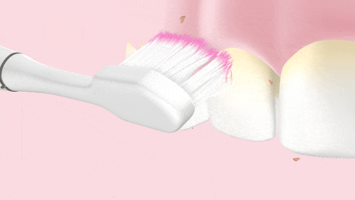 GUM® SONIC SENSITIVE Battery toothbrush removes more plaque