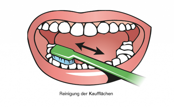 toothbrushing-cleaning-occlusal-surface.png