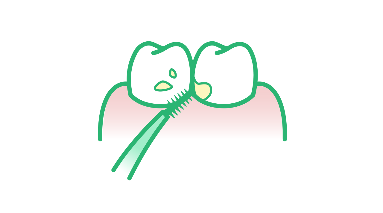 Nettoyage entre les dents avec un bâtonnet