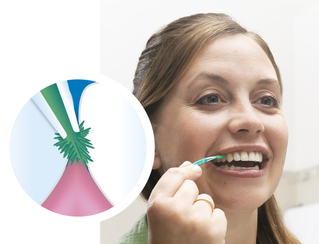 How to Floss with Braces 4 Easy Ways to a Healthy Smile