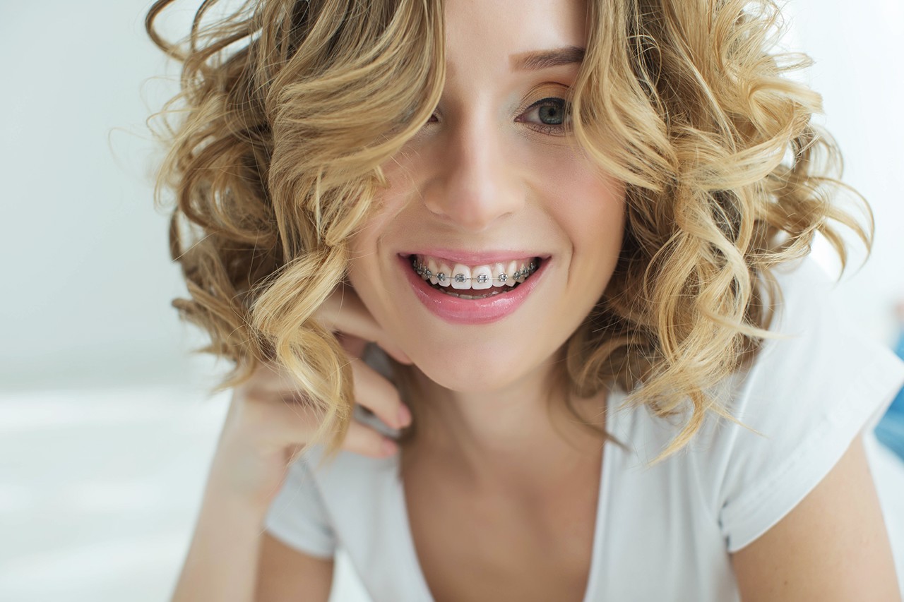 How to Clean your Teeth with Braces to Keep them Clean and Healthy
