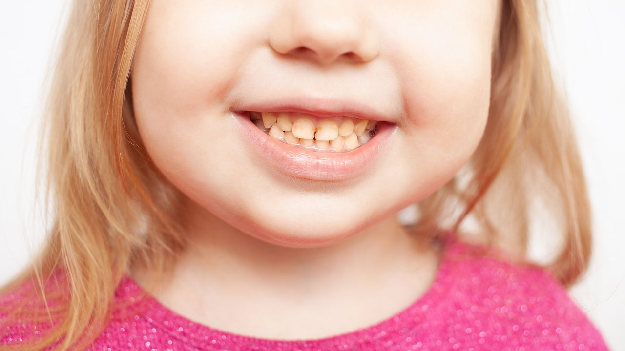 Denti Gialli nei Bambini: cause, rimedi e prevenzione | GUM®