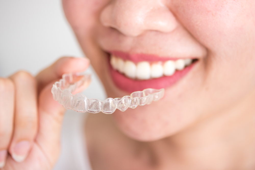 Aparat Invisalign – czym jest i jak działa niewidoczny aparat ortodontyczny?
