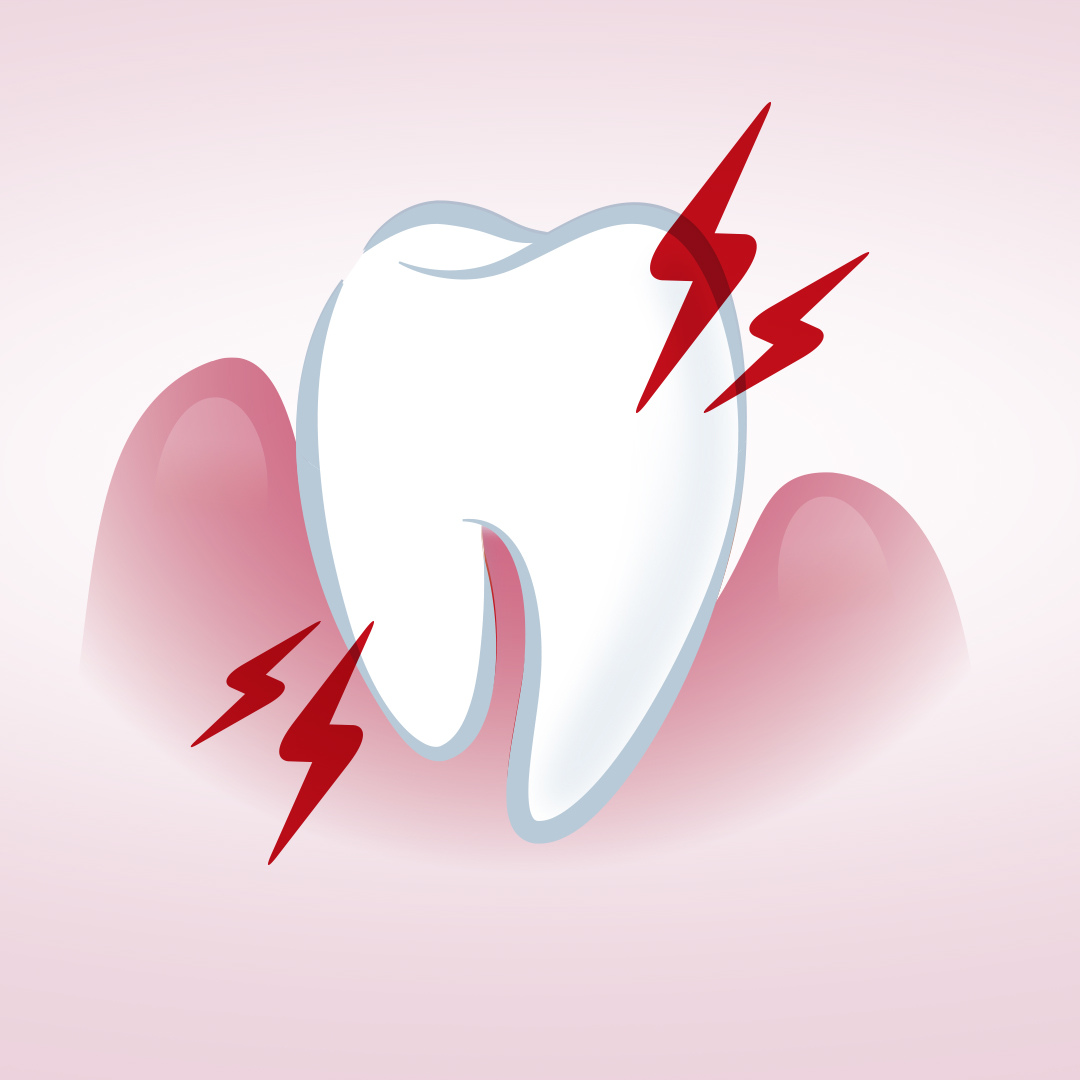 A tooth with lightning to show sensitivity